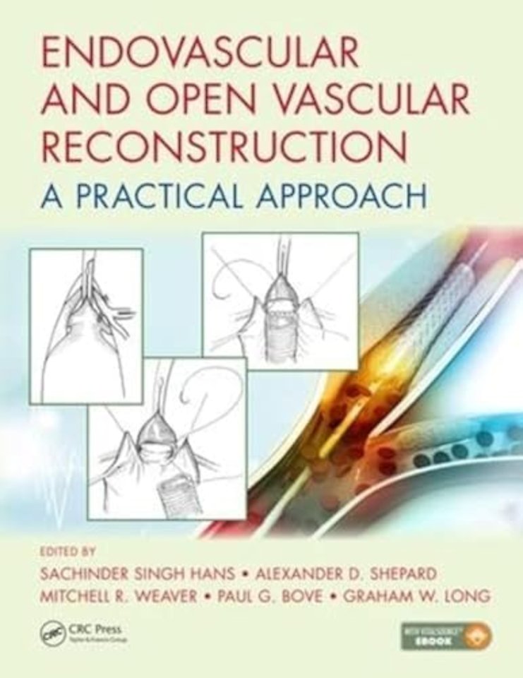 Endovascular and Open Vascular Reconstruction