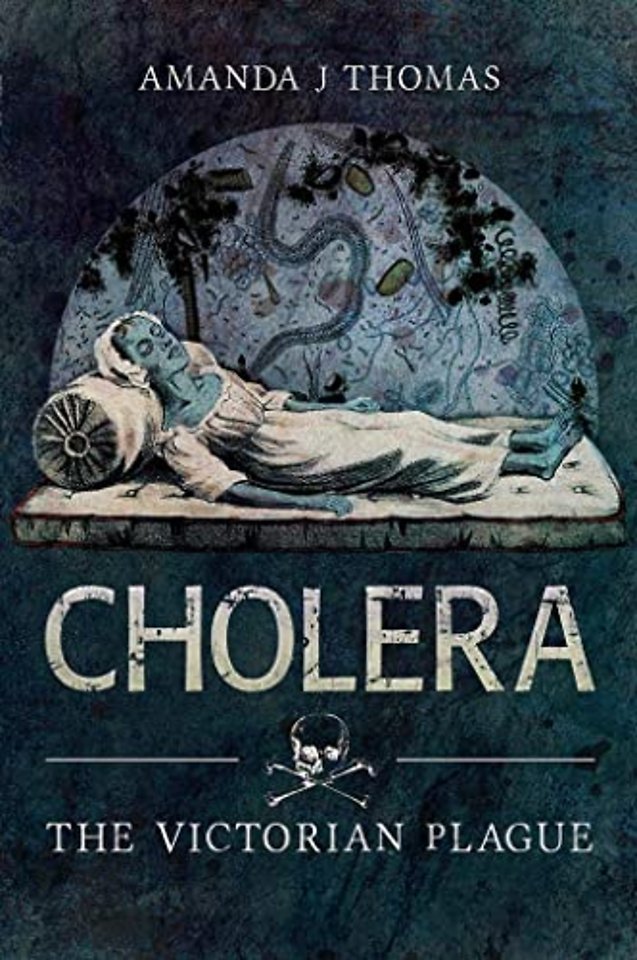 Cholera