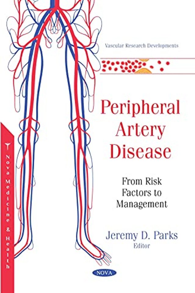 Peripheral Artery Disease