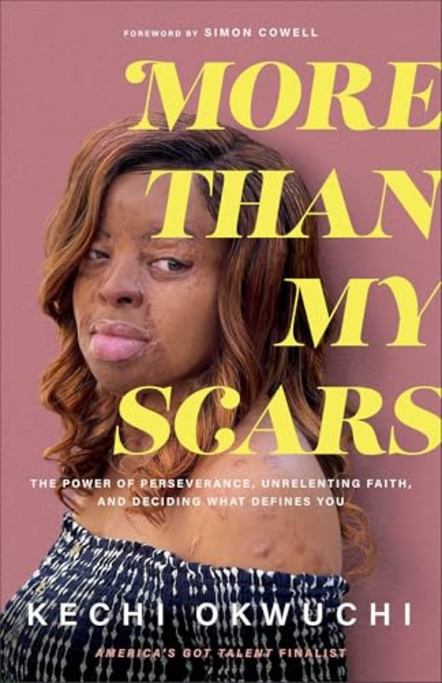 More Than My Scars – The Power of Perseverance, Unrelenting Faith, and Deciding What Defines You