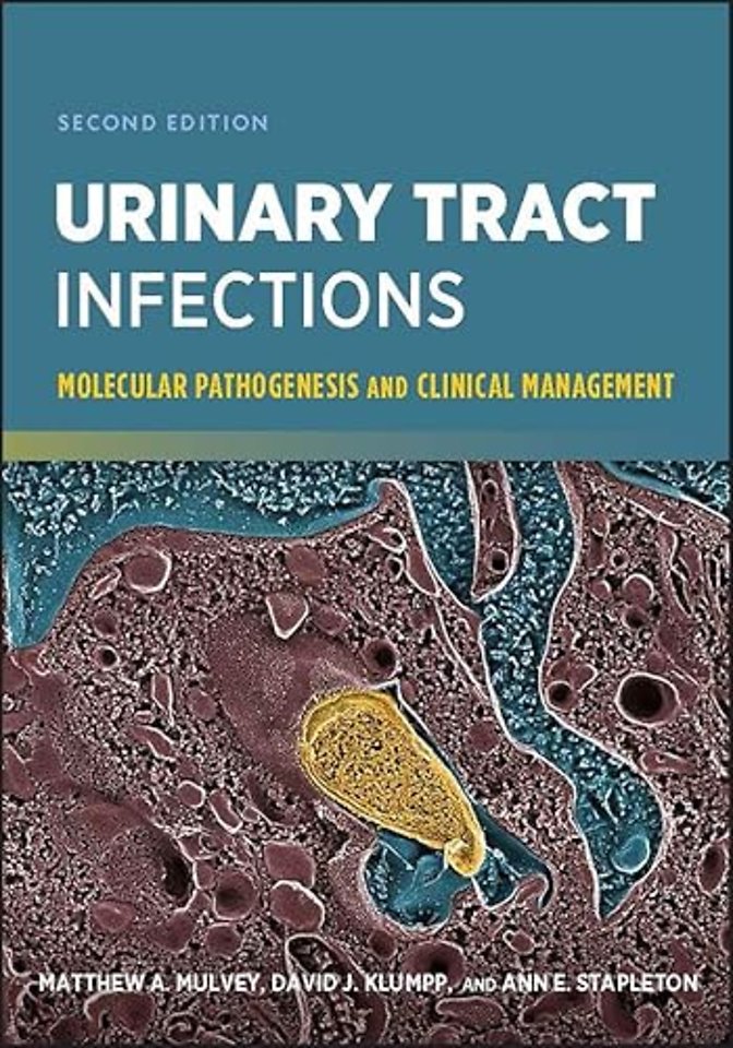 Urinary Tract Infections