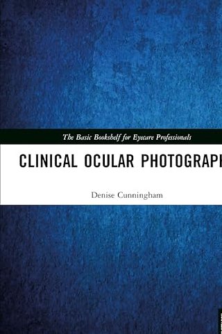 Clinical Ocular Photography