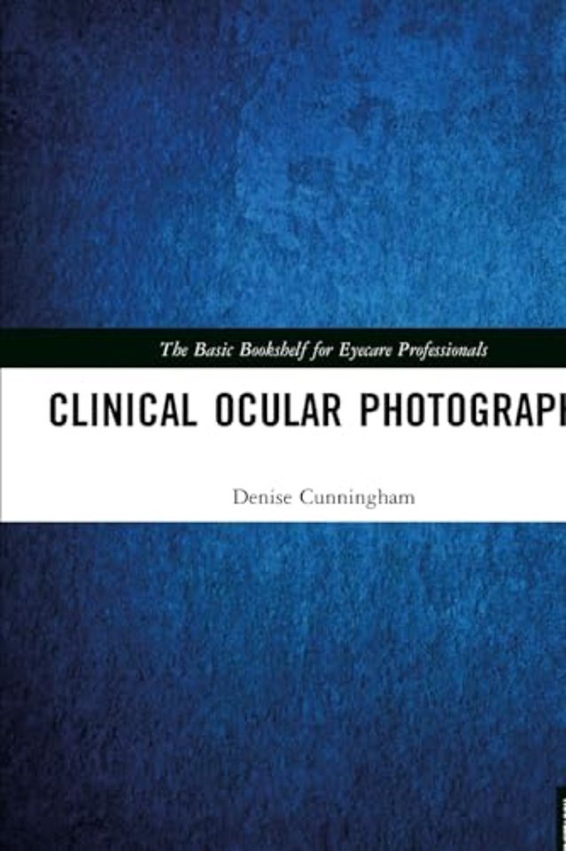 Clinical Ocular Photography