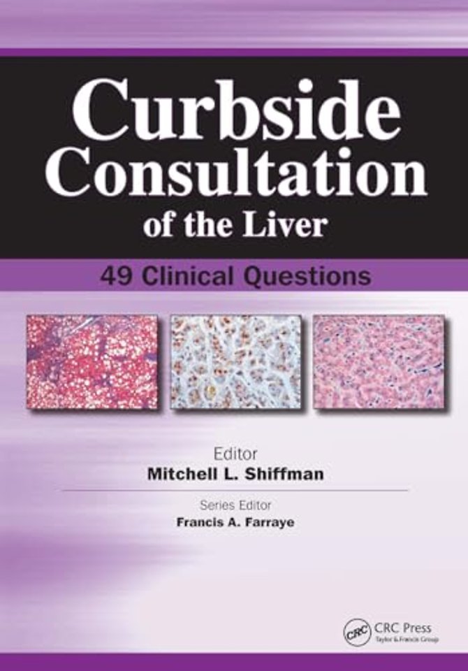 Curbside Consultation of the Liver