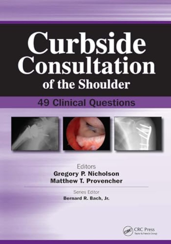 Curbside Consultation of the Shoulder