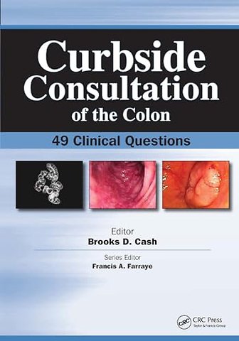 Curbside Consultation of the Colon