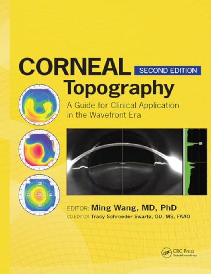 Corneal Topography
