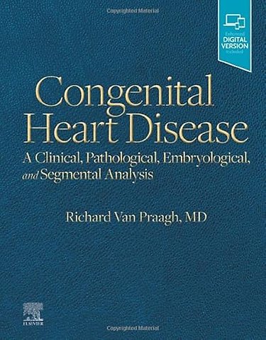 Congenital Heart Disease