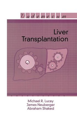 Liver Transplantation