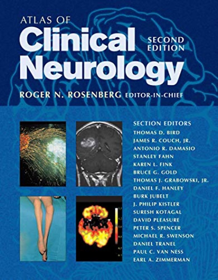 Atlas of Clinical Neurology