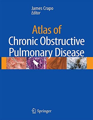 Atlas of Chronic Obstructive Pulmonary Disease