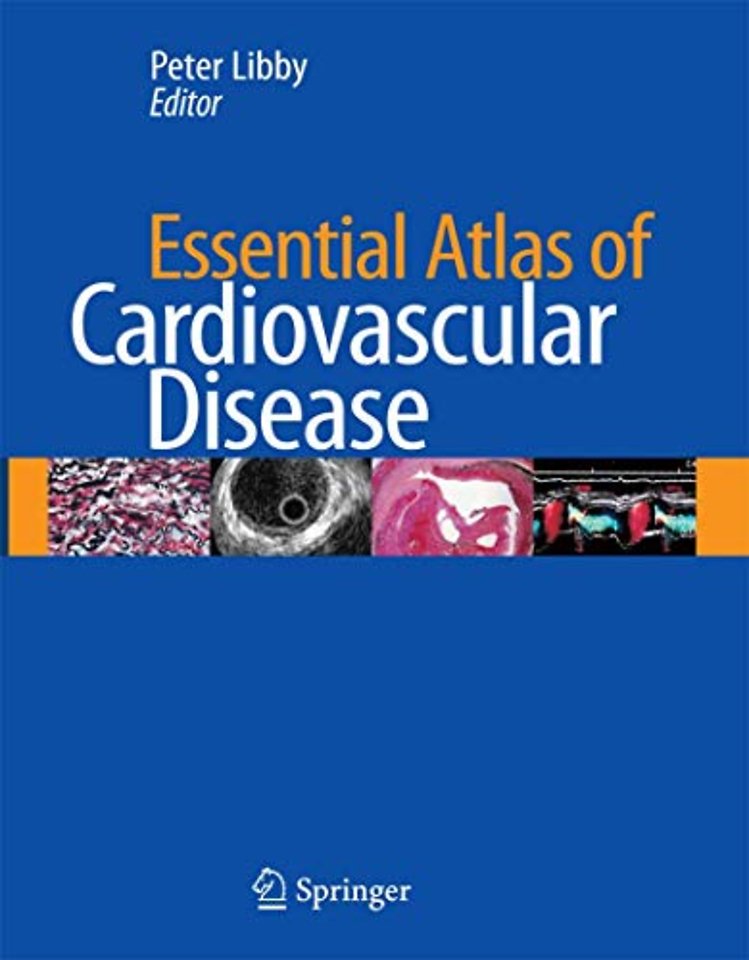 Essential Atlas of Cardiovascular Disease