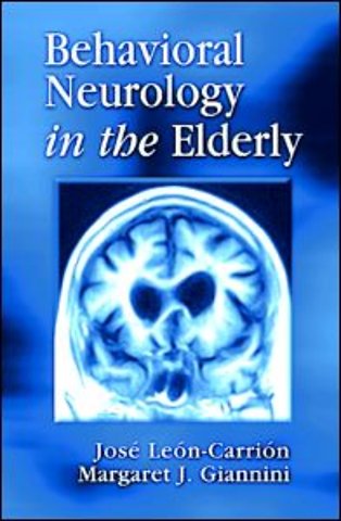 Yield ManagementThe Leadership Alternative for Performance and Net Profit Improvement