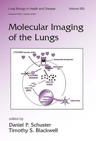 Molecular Imaging of the Lungs