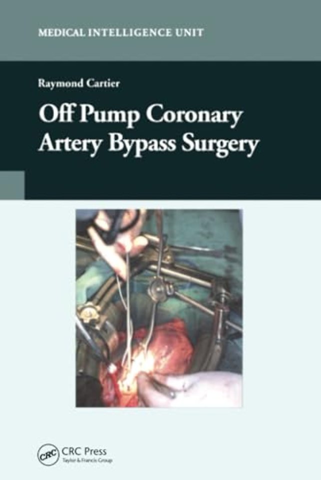 Off-Pump Coronary Artery Bypass Surgery