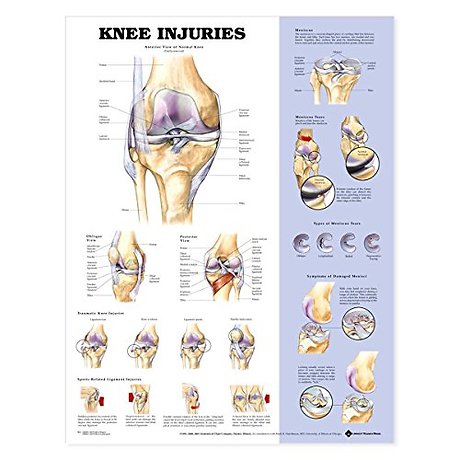 Knee Injuries Anatomical Chart