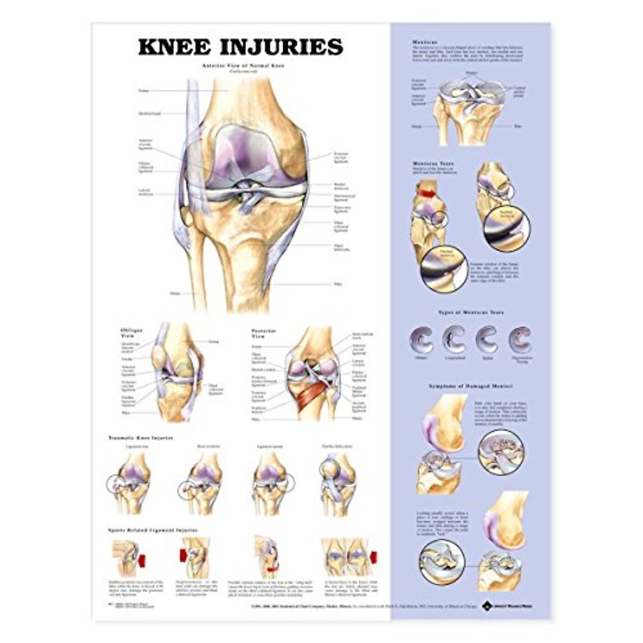 Knee Injuries Anatomical Chart