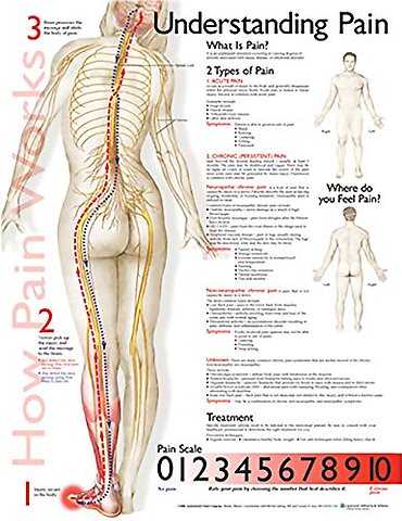 Understanding Pain Anatomical Chart