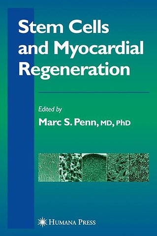 Stem Cells and Myocardial Regeneration