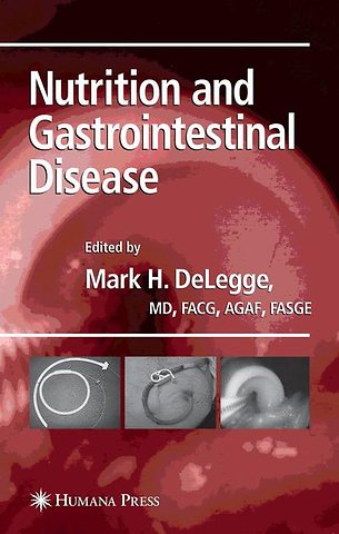 Nutrition and Gastrointestinal Disease