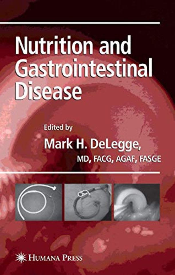Nutrition and Gastrointestinal Disease