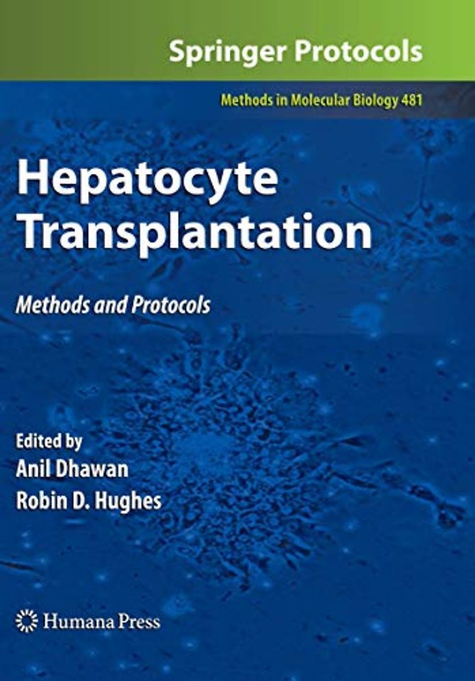 Hepatocyte Transplantation