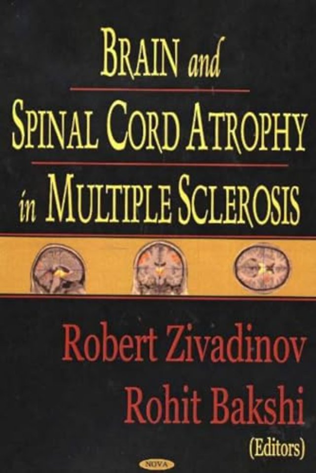 Brain & Spinal Cord Atrophy in Multiple Sclerosis