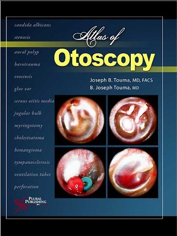 Atlas of Otoscopy