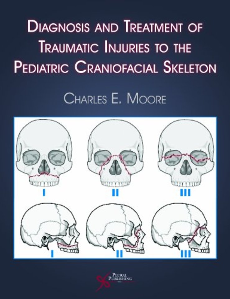 Diagnosis and Treatment of Traumatic Injuries to the Pediatric Craniofacial Skeleton