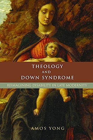 Theology and Down Syndrome – Reimagining Disability in Late Modernity