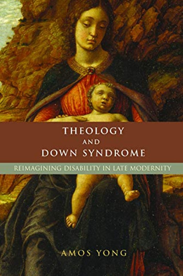 Theology and Down Syndrome – Reimagining Disability in Late Modernity