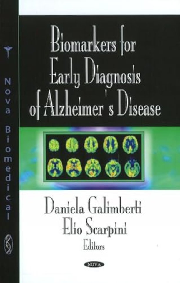 Biomarkers for Early Diagnosis of Alzheimer's Disease