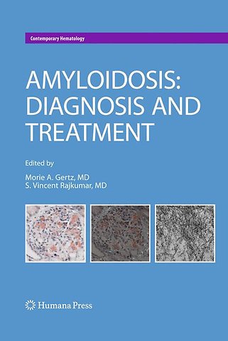 Amyloidosis