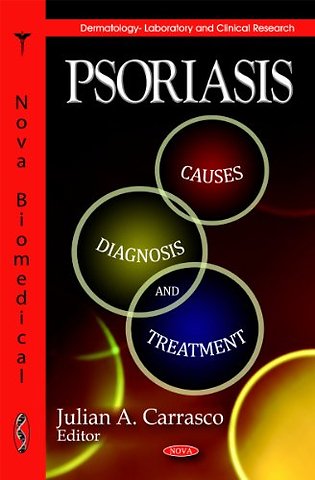 Psoriasis