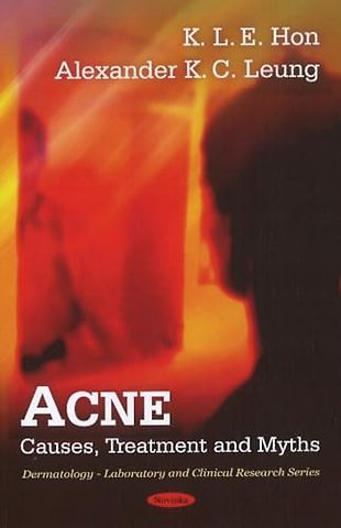 Acne