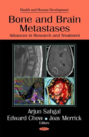 Bone & Brain Metastases