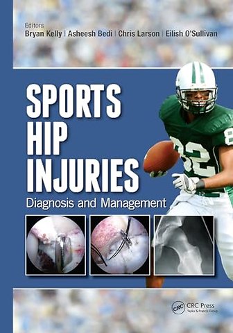 Sports Hip Injuries
