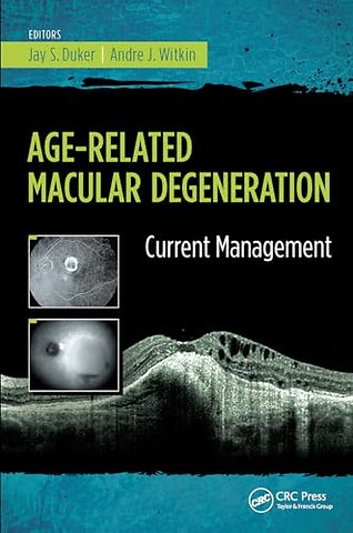 Age-Related Macular Degeneration