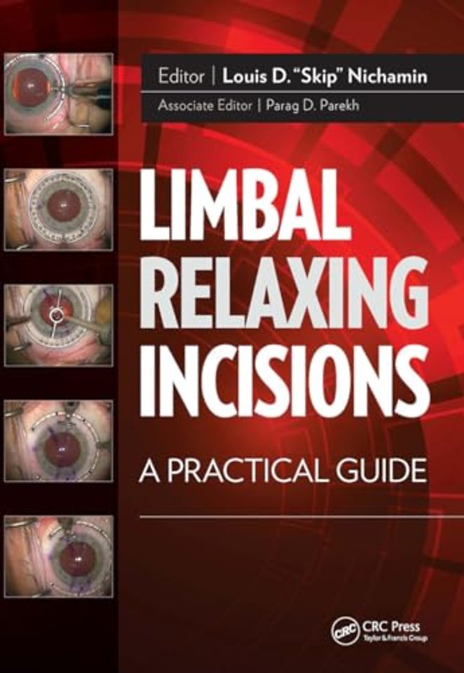 Limbal Relaxing Incisions