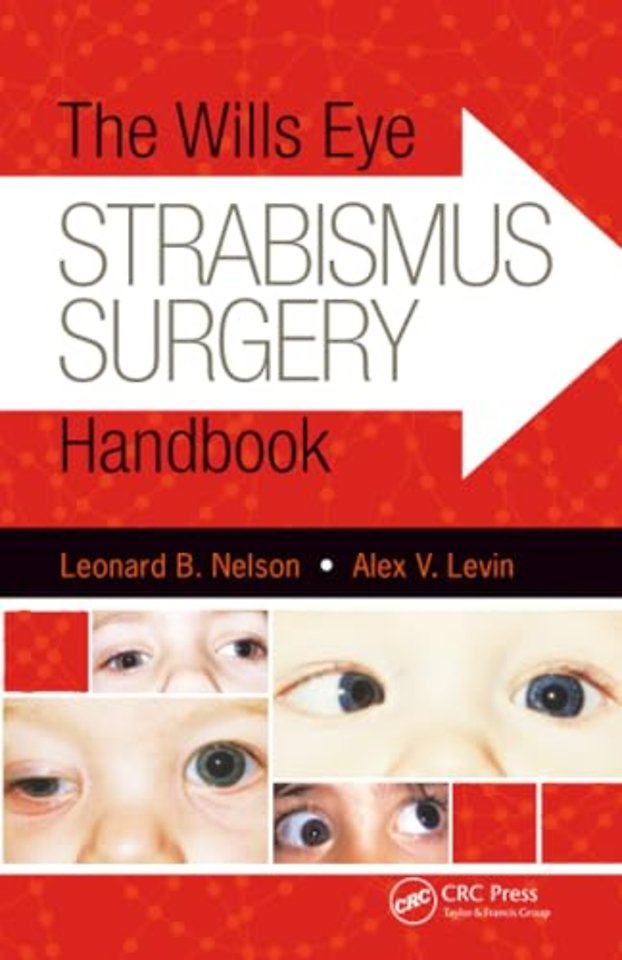 The Wills Eye Strabismus Surgery Handbook