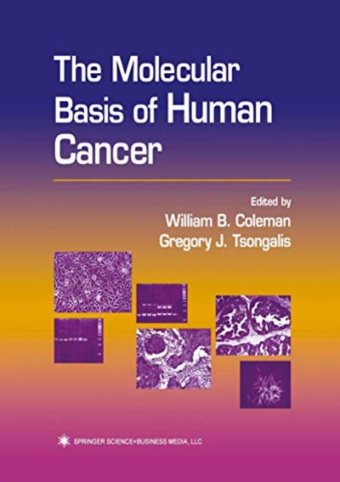 The Molecular Basis of Human Cancer