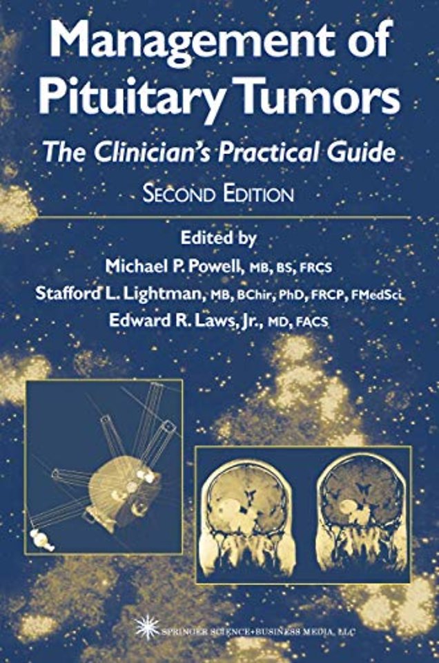 Management of Pituitary Tumors