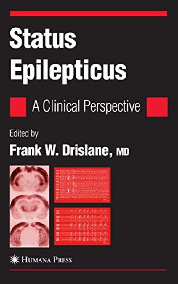 Status Epilepticus