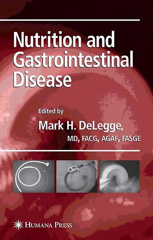 Nutrition and Gastrointestinal Disease