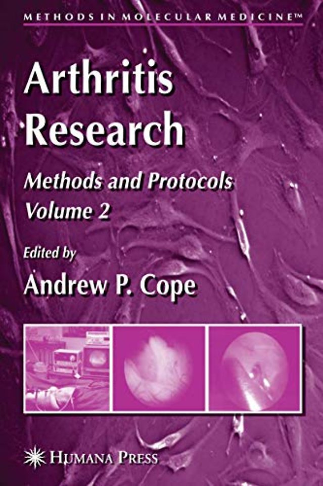 Arthritis Research