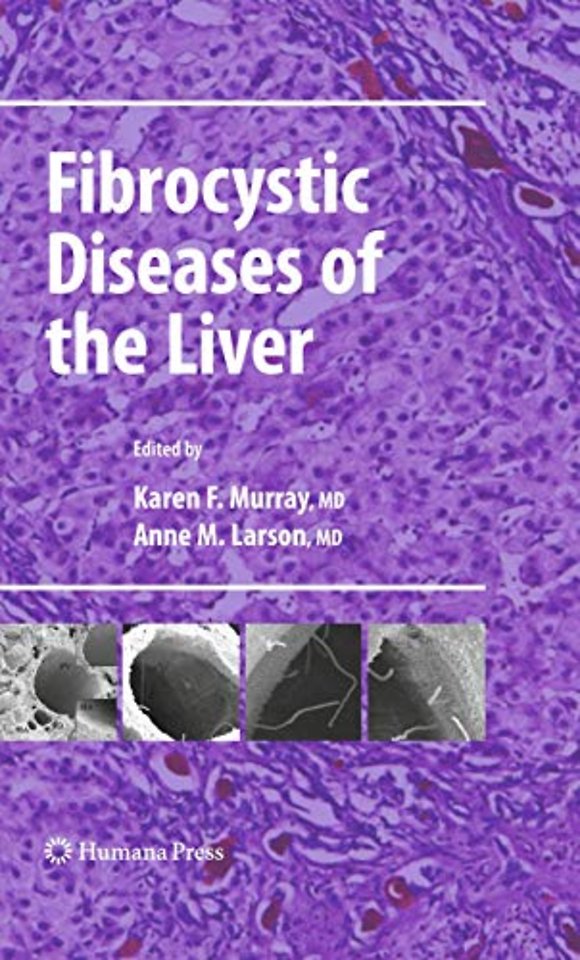 Fibrocystic Diseases of the Liver