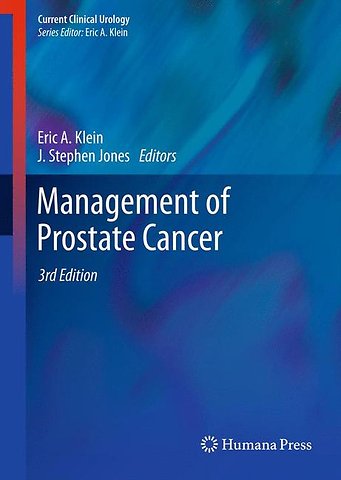 Management of Prostate Cancer