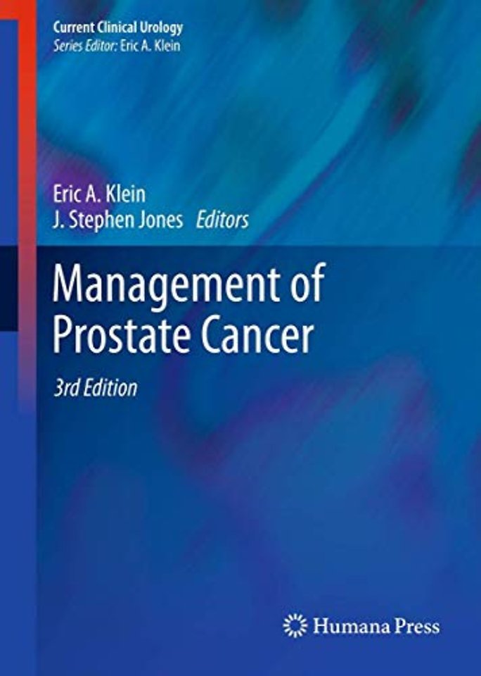Management of Prostate Cancer