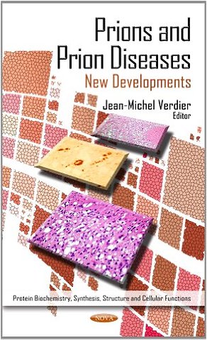 Prions & Prion Diseases
