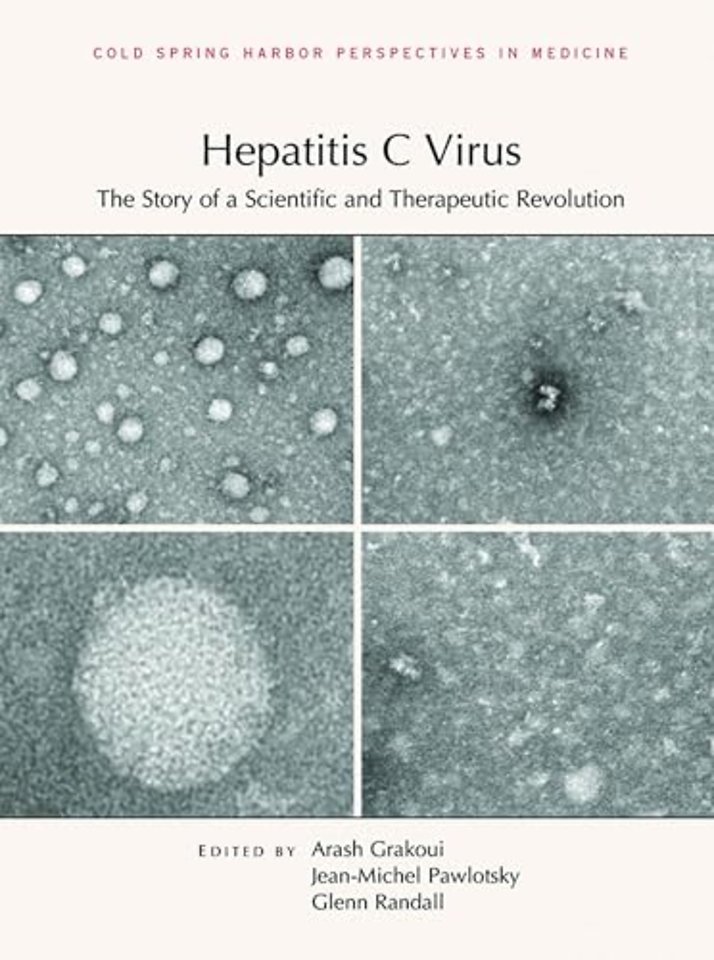 Hepatitis C Virus